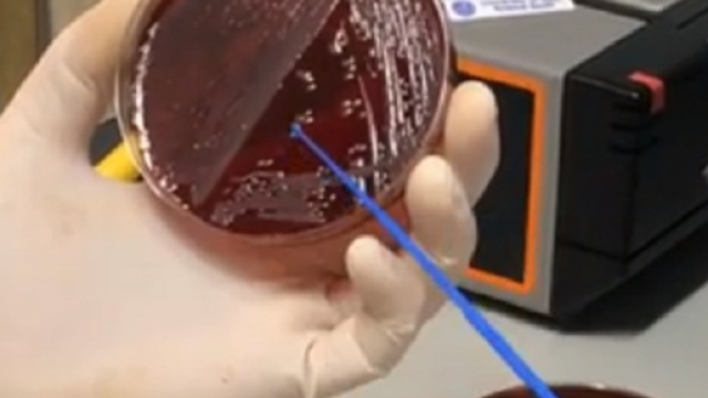Stafilococco, il batterio che può diventare letale