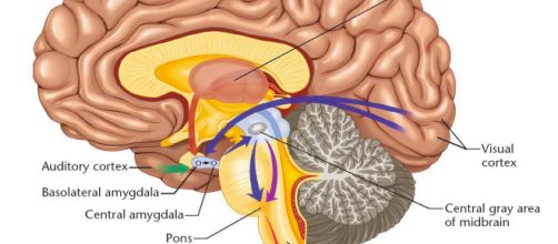 Neurofibromatosi: nuove possibilità di cura dalla mappatura del cervello