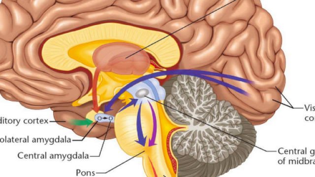Neurofibromatosi: nuove possibilit&agrave; di cura dalla mappatura del cervello