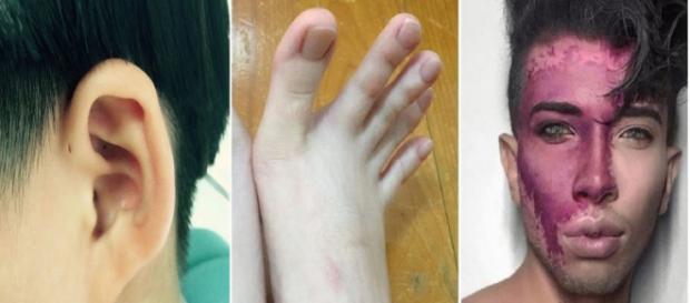 Pessoas com condições genéticas raras. (Foto: Reprodução) Pessoas com condições genéticas raras. (Foto: Reprodução)