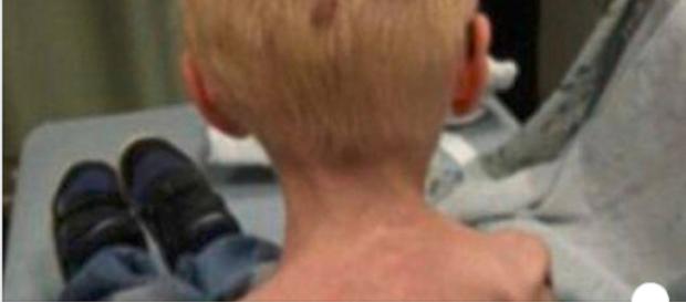 Segregato nello stanzino dalla matrigna: a 5 anni pesa 13 chili, costretto a mettere il pannolino - Il Mattino Segregato nello stanzino dalla matrigna: a 5 anni pesa 13 chili, costretto a mettere il pannolino - Il Mattino