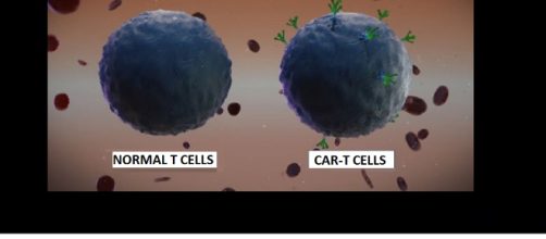 Moderne terapie con anticorpi monoclonali e terapie cellulari CAR-T stanno dando importanti risultati nella lotta contro il mieloma multiplo