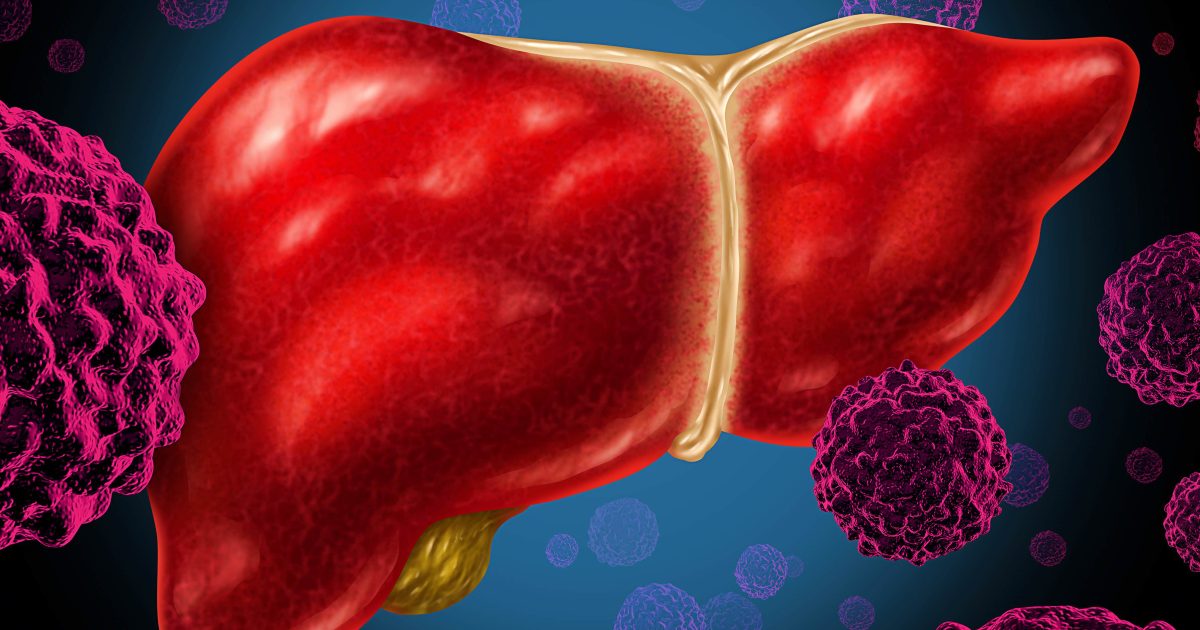 Tumore Al Fegato: Cinque Indicazioni Per Aiutare La Prevenzione