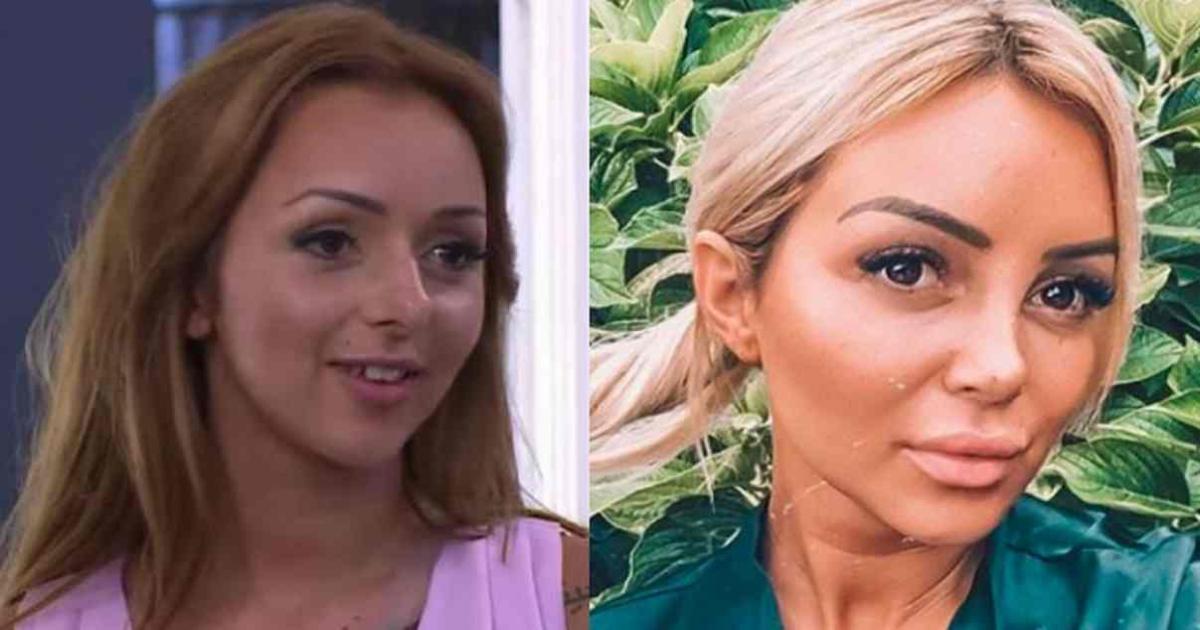 Face aux critiques, Fidji se confie sur sa chirurgie esthétique 'ça