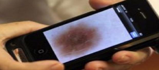 Treviso: Donna scopre di avere un tumore grazie allo smartphone Treviso: Donna scopre di avere un tumore grazie allo smartphone