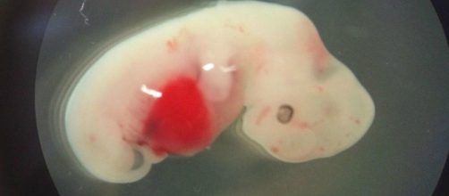 Creato embrione ibrido uomo-pecora con l'intento di utilizzarlo per i trapianti d'organo