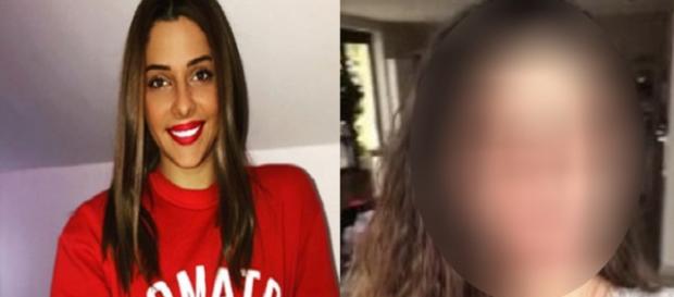 Coralie Porrovecchio brûlée par les UV, découvrez le résultat Coralie Porrovecchio brûlée par les UV, découvrez le résultat