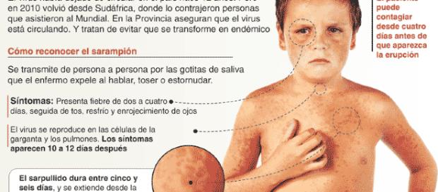 Los casos se cuadruplicaron, con más de 20,000 personas afectadas y 35 muertes. Quince países de la región europea Los casos se cuadruplicaron, con más de 20,000 personas afectadas y 35 muertes. Quince países de la región europea