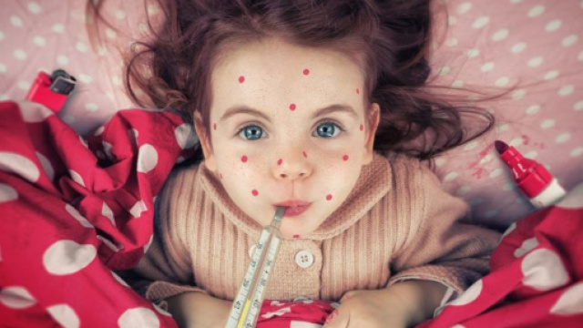 Vaccino contro il morbillo: quando si fa e perché è importante - gioia.it