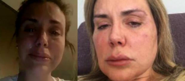 Renata Banhara desabafa após traição e agressão: "Será que sou forte?" (Foto Reprodução). Renata Banhara desabafa após traição e agressão: "Será que sou forte?" (Foto Reprodução).