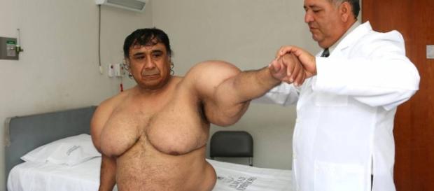 peruano que sufre una extraña enfermedad peruano que sufre una extraña enfermedad