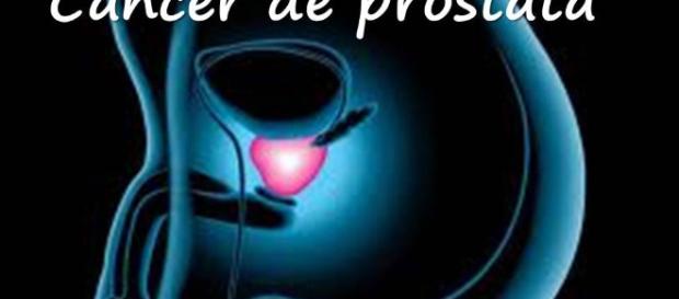 Cancer de Prostata como detectarlo y tratarlo - YouTube - youtube.com Cancer de Prostata como detectarlo y tratarlo - YouTube - youtube.com