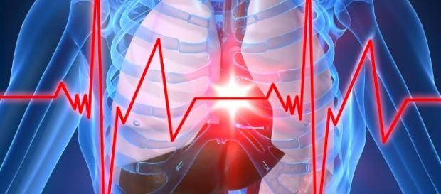 Cómo evitar un infarto de miocardio o un accidente vascular ... - diariote.mx Cómo evitar un infarto de miocardio o un accidente vascular ... - diariote.mx