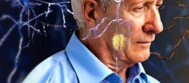 Fármaco frena muerte neuronal en Alzheimer - com.ar Fármaco frena muerte neuronal en Alzheimer - com.ar