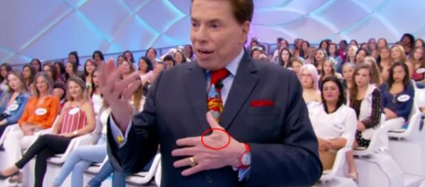 Mancha estranha na mão de Silvio Santos causa preocupação Mancha estranha na mão de Silvio Santos causa preocupação