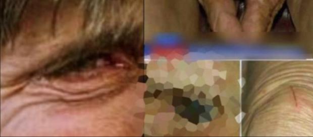 Mulher idosa sofreu horrores nas mãos do seu filho, de 54 anos Mulher idosa sofreu horrores nas mãos do seu filho, de 54 anos