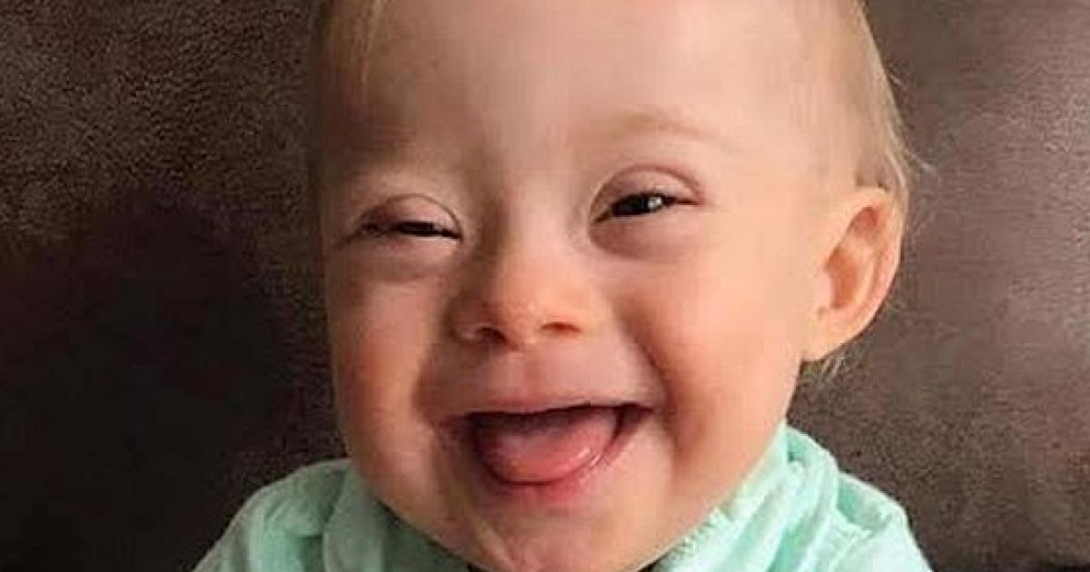 For the first time a Gerber baby has Down syndrome