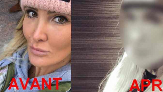 La chirurgie esthétique de trop pour Marie Garet ?