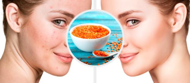 Las mascarillas faciales ayudan a recuperar el cutis. - mejorconsalud.com Las mascarillas faciales ayudan a recuperar el cutis. - mejorconsalud.com