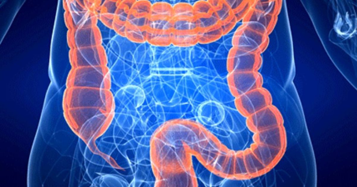 Tumore Al Colon Retto: Ricerca Italiana Scopre Nuova Terapia