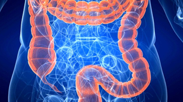 Tumore del colon retto: nuova cura sperimentata a Padova