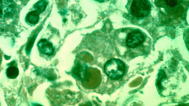 Malattia X: un patogeno ancora sconosciuto