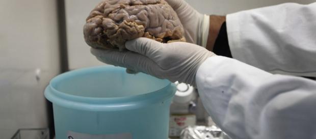 La cocaína provoca cambios en el cerebro que favorecen la adicción - cuatro.com La cocaína provoca cambios en el cerebro que favorecen la adicción - cuatro.com