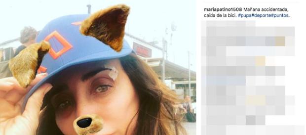 María Patiño sufre un accidente mientras practicaba deporte. María Patiño sufre un accidente mientras practicaba deporte.