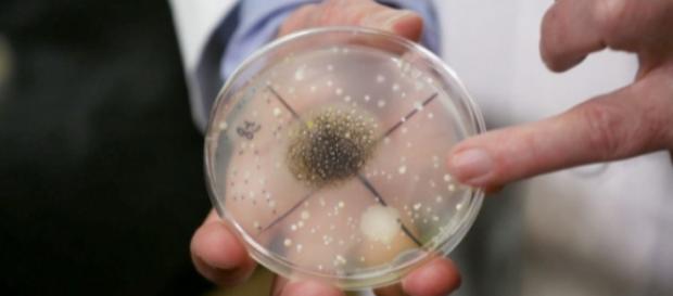 Análises em amostras de maquiagem revelam contaminação por bactérias Análises em amostras de maquiagem revelam contaminação por bactérias