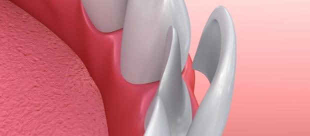 Zubident – Dentista en la Zubia - wordpress.com Zubident – Dentista en la Zubia - wordpress.com