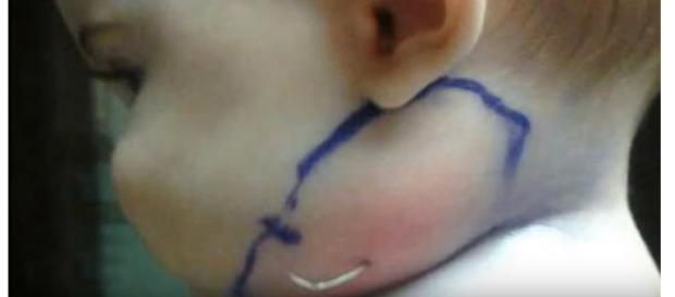 Os médicos ficaram impressionados Os médicos ficaram impressionados