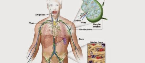 ganglios inflamados garganta cancer