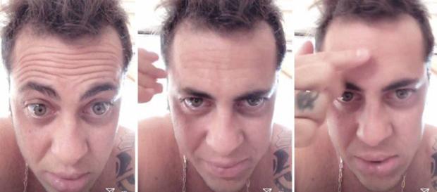 Thammy diz que está ficando careca. (Reprodução/Instagram) Thammy diz que está ficando careca. (Reprodução/Instagram)