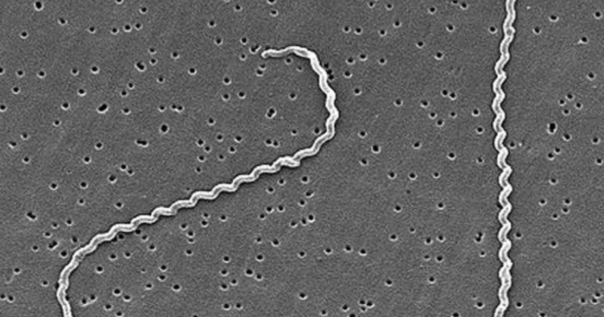 Científicos Descubren Nueva Bacteria Causante De Leptospirosis