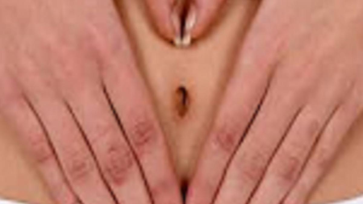 Papiloma humano en el cuello uterino imagenes