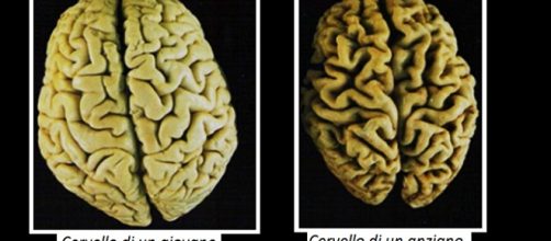 Solo il cervello umano (ipotalamo) riesce a rigenerarsi (neurogenesi) a qualsiasi età