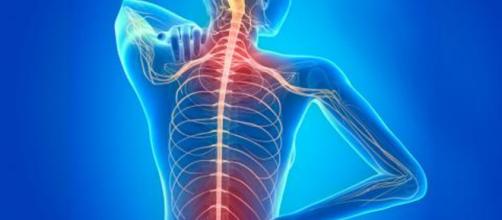 Sistema nervioso afectado por la esclerosis múltiple