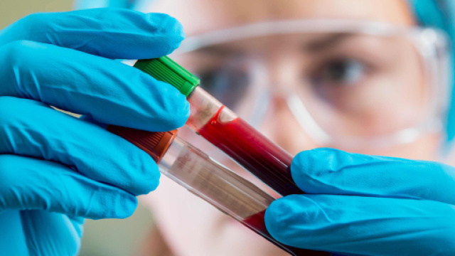 Ricercatrice al lavoro (Fonte: nhlbi.nih.gov)