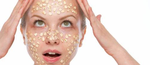 Remedios naturales para el acné