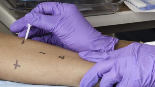 Allergie: nuovi studi per prevenirle (fonte hindustantimes.com)