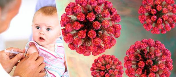 Rubéola - Mejor con Salud - mejorconsalud.com Rubéola - Mejor con Salud - mejorconsalud.com