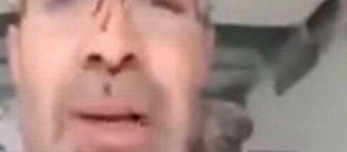 Un fermo immagine dell'uomo che dopo aver ucciso la moglie ha fatto una diretta Facebook con il volto ancora insanguinato