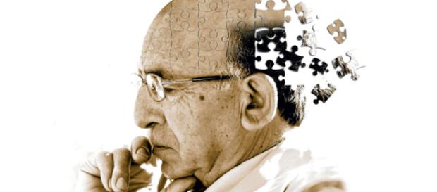 Investigadores de Alzheimer ganan premio intelectual. Investigadores de Alzheimer ganan premio intelectual.
