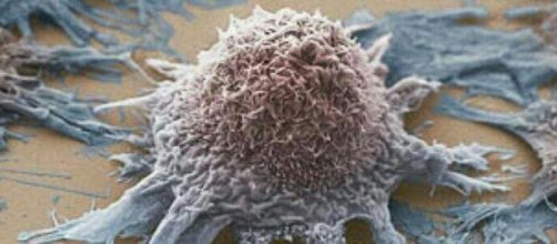 Nuove speranze per la cura dei tumori: annullata l'azione di una proteina che sviluppa le cellule tumorali (fonte infooggi.it )