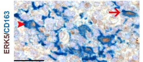 Accoppiamento ERK5-Macrofago (http://www.pnas.org/content/early/2018/02/28/1707929115/tab-figures-data, adattato)