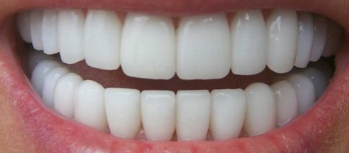 Protesi dentarie, scatta l'allarme di materiali tossici