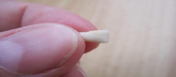 Com os dentes de leite é possível armazenar células-tronco Com os dentes de leite é possível armazenar células-tronco