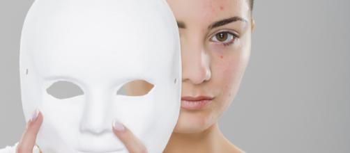 Como eliminar el acne por problemas hormonales