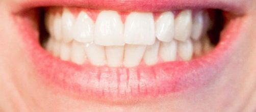 Denti che cadono: cause, rimedi e prevenzione – Non Solo Salute - nonsolosalute.com