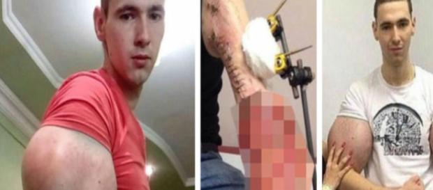 Homem ficou famoso por injetar óleo no corpo. Ele fez grande sucesso no mundo. Homem ficou famoso por injetar óleo no corpo. Ele fez grande sucesso no mundo.